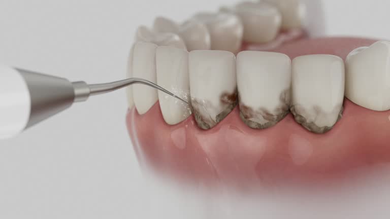 Trusted Dental Crowns And Bridges service in Cross Plains, TX - Dentist Open Now